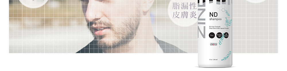 脂漏性皮膚炎