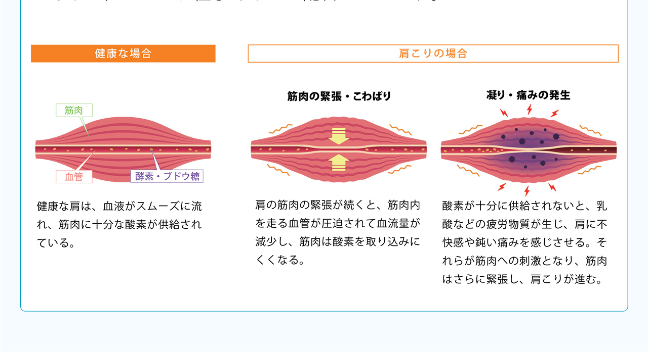 健康な場合：健康な肩は血液がスムーズに流れ、筋肉に十分な酸素が供給されている。肩こりの場合L肩の筋肉の緊張が続くと、筋肉内を走る血管が圧迫されて血流量が減少し、筋肉は酸素を取り込みにくくなる