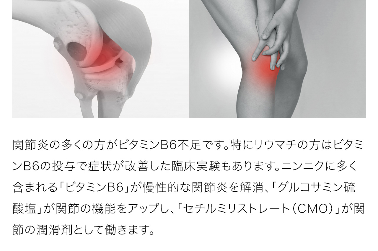 関節炎の多くの方がビタミンB6不足です。特にリウマチの方はビタミンB6の投与で症状が改善した臨床実験もあります。ニンニクに多く含まれる「ビタミンB6」が慢性的な関節炎を解消、「グルコサミン硫酸塩」が関節の機能をアップし、「セチルミリストレート（CMO）」が関節の潤滑剤として働きます