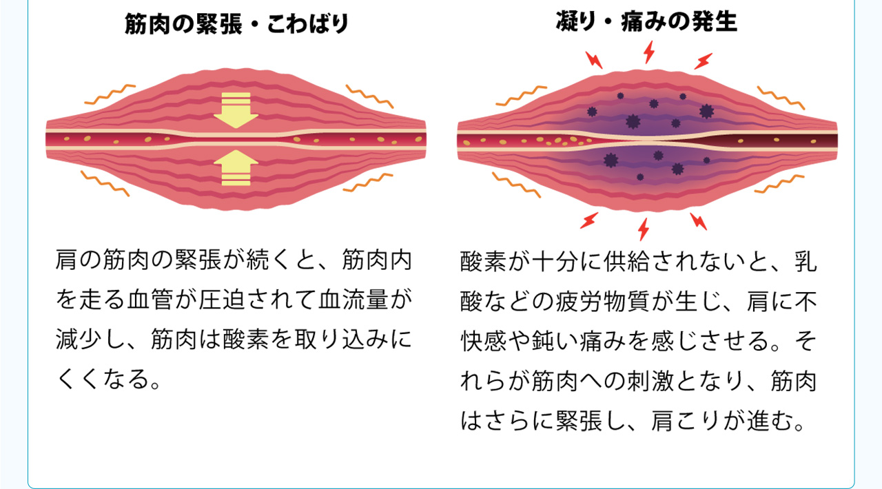 肩の筋肉の緊張が続くと筋肉ないを走る血管が圧迫されて血流が減少し、筋肉は酸素を取り込みにくくなる
