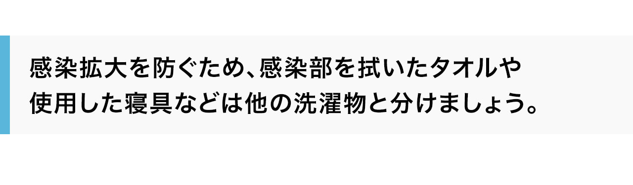 感染拡大を防ぐため、感染部を拭いたタオルや使用した寝具などは他の洗濯物と分けましょう。