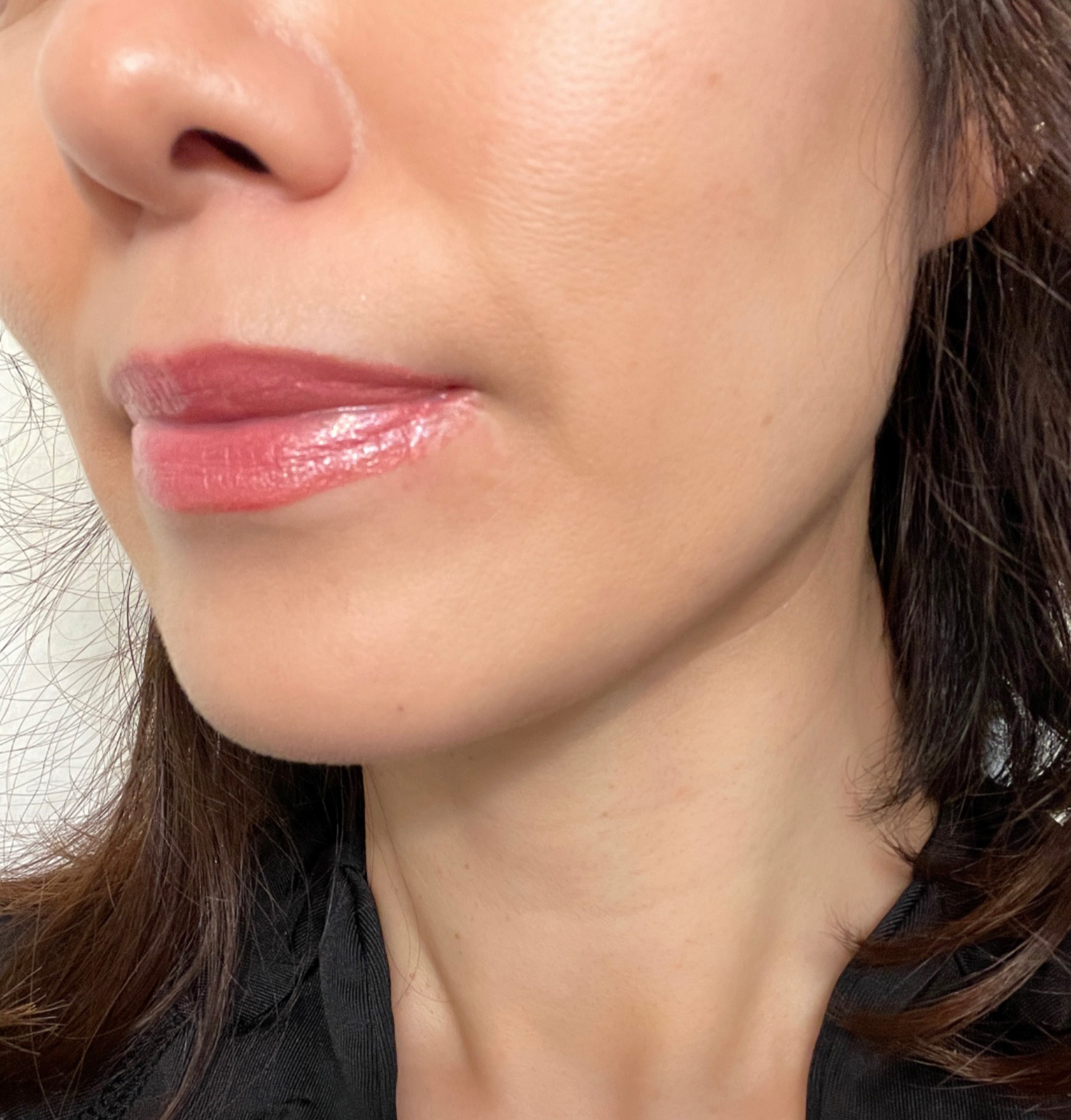 スタッフがヘルペパッチつけてみました