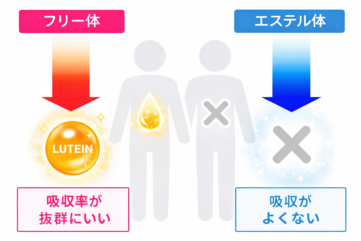 フリー体を選ぶ理由