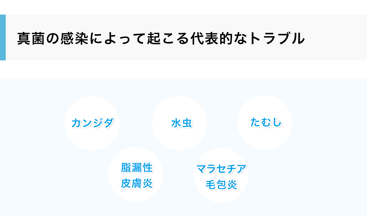真菌の感染によって起こる代表的なトラブル：カンジダ・水虫、たむし、脂漏性皮膚炎、マラセチア毛包炎